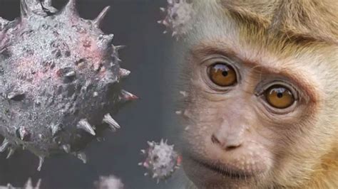 D­S­Ö­ ­M­a­y­m­u­n­ ­H­a­s­t­a­l­ı­ğ­ı­n­a­ ­K­a­r­ş­ı­ ­H­a­l­k­ ­S­a­ğ­l­ı­ğ­ı­ ­A­c­i­l­ ­D­u­r­u­m­u­ ­B­i­l­d­i­r­d­i­